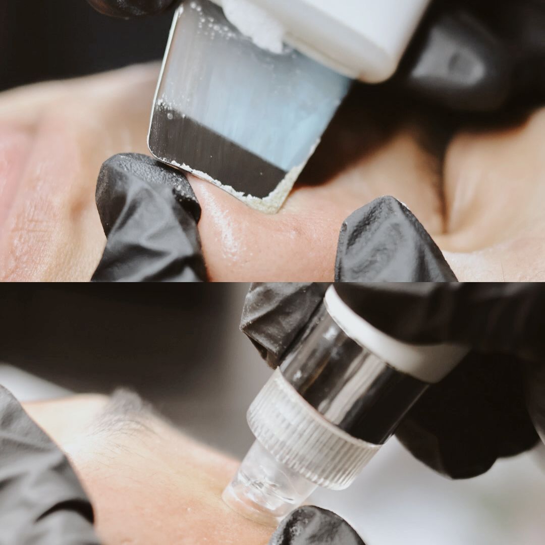 Tratamiento Facial