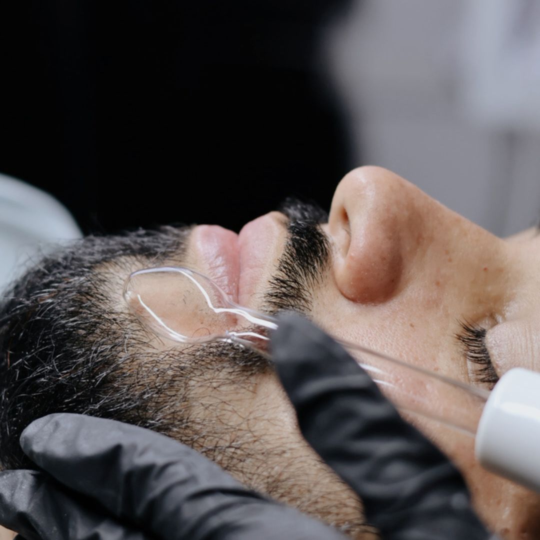 Tratamiento Facial