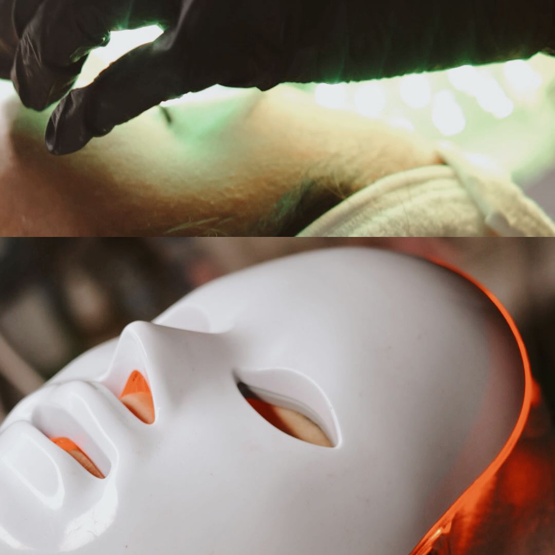 Tratamiento Facial